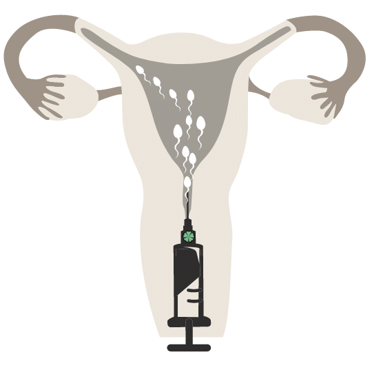 Bechermethode - Heiminsemination - Durchführung Insemination