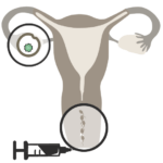 01 - HI - Heim Insemination - Bechermethode