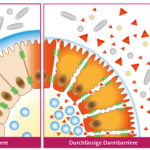 Vergleich einer intakten Darmbarriere mit einem „löchrigen Darm“