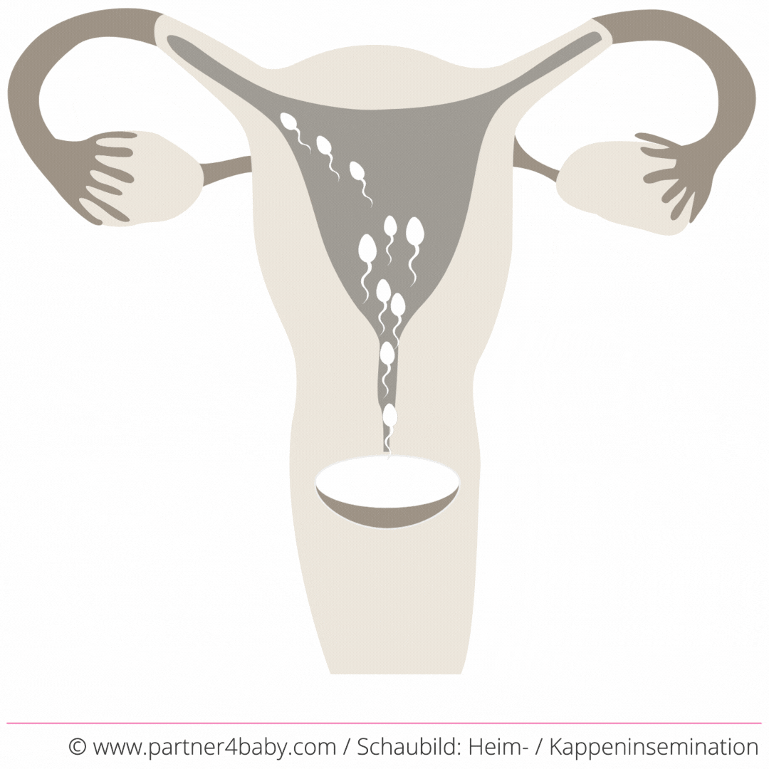 Schaubild: Kappeninsemination